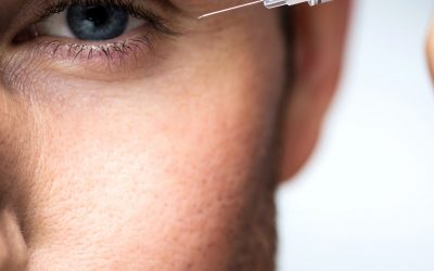 Toxina botulínica en hombres: mitos y verdades