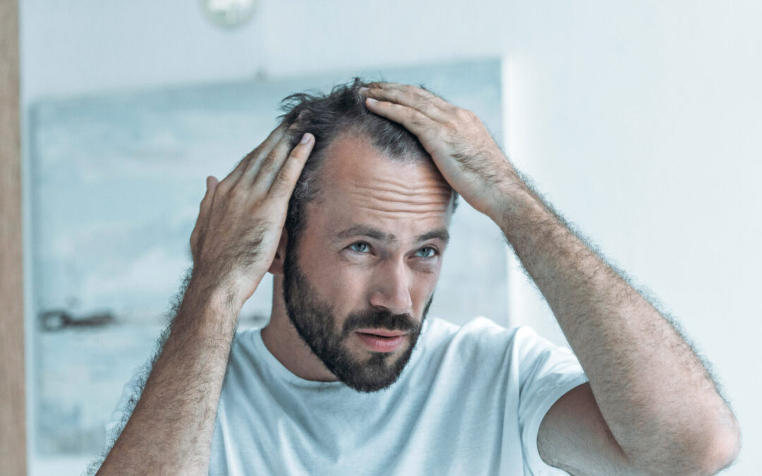 Alopecia, los musts para detener y revertir la caída de cabello